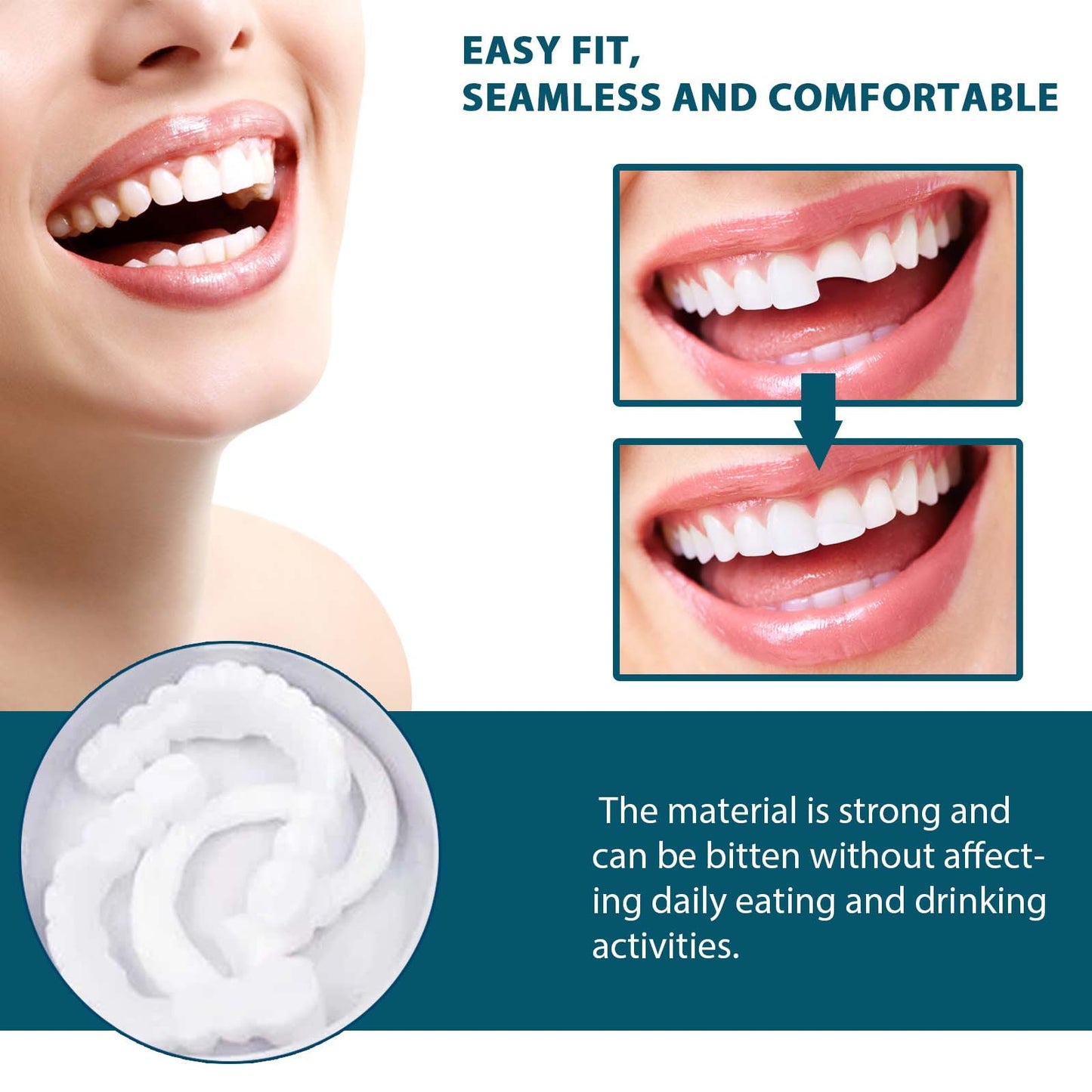 Adjustable Custom-Adaptive Denture System Snap-on Dentures