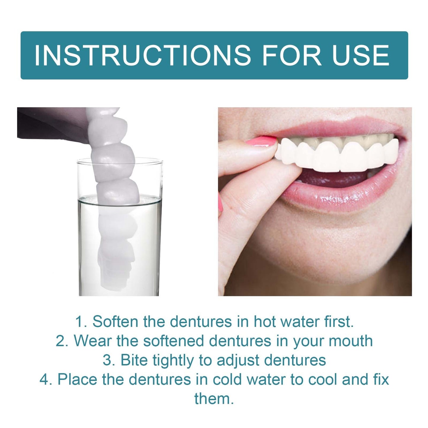 Adjustable Custom-Adaptive Denture System Snap-on Dentures